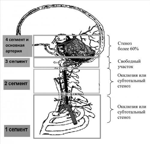 Схема лечения вбн